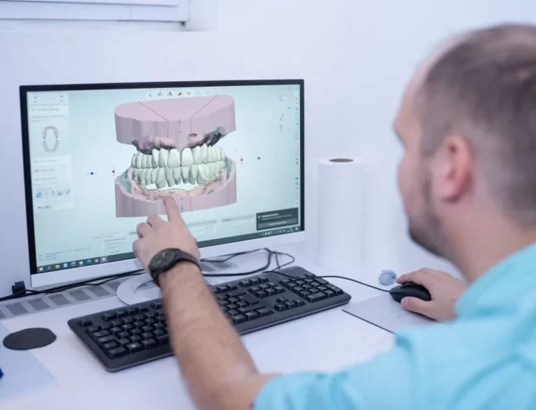 In einfacheren Fällen stellt der Zahnarzt die hochwertigen Keramikschalen mit dem CAD-CAM-Computerverfahren, dem CEREC-System