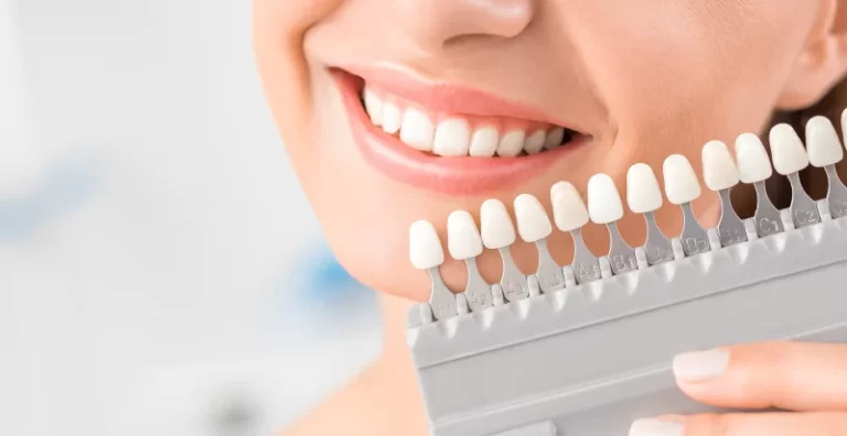 Was sind die Vor- und Nachteile der Zahnaufhellung zu Hause